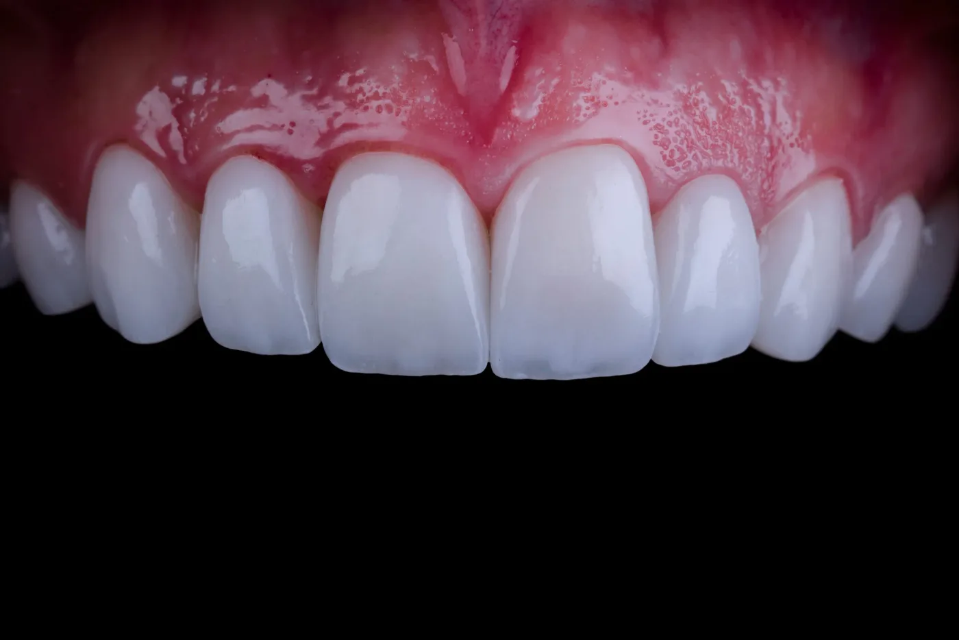 shutterstock 1591401301 scaled