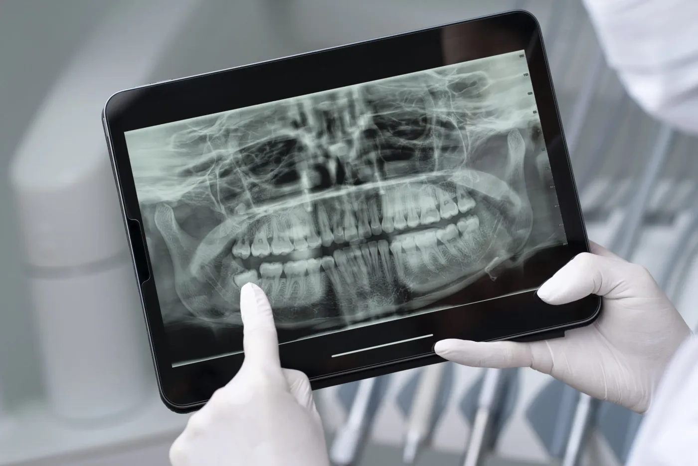 Radiografia dentară îți oferă un diagnostic corect. Dentetico îți explică!