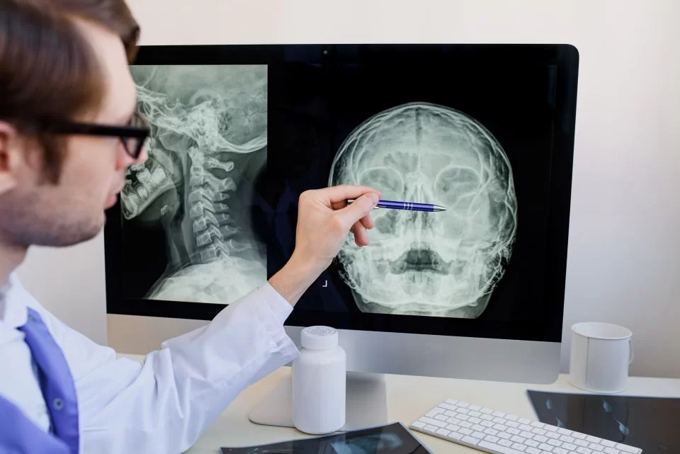 doctor explica sinuzita