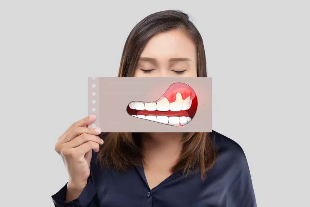 infectie dentară