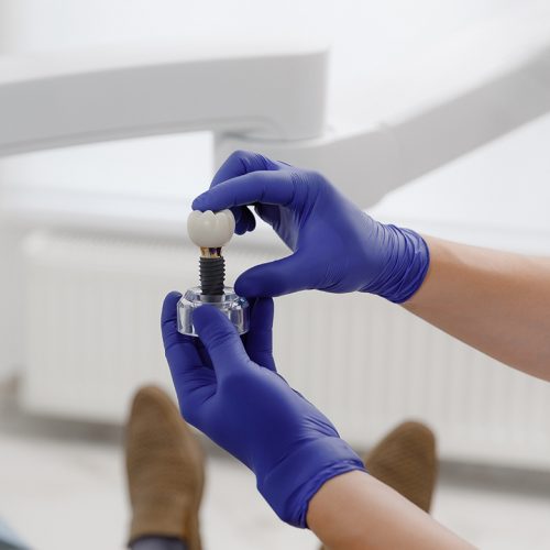Etapele implantului dentar la clinica Dentetico