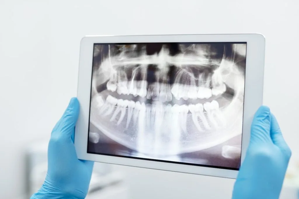 Medic stomatolog explica pacientului interpretarea radiografiei panoramice
