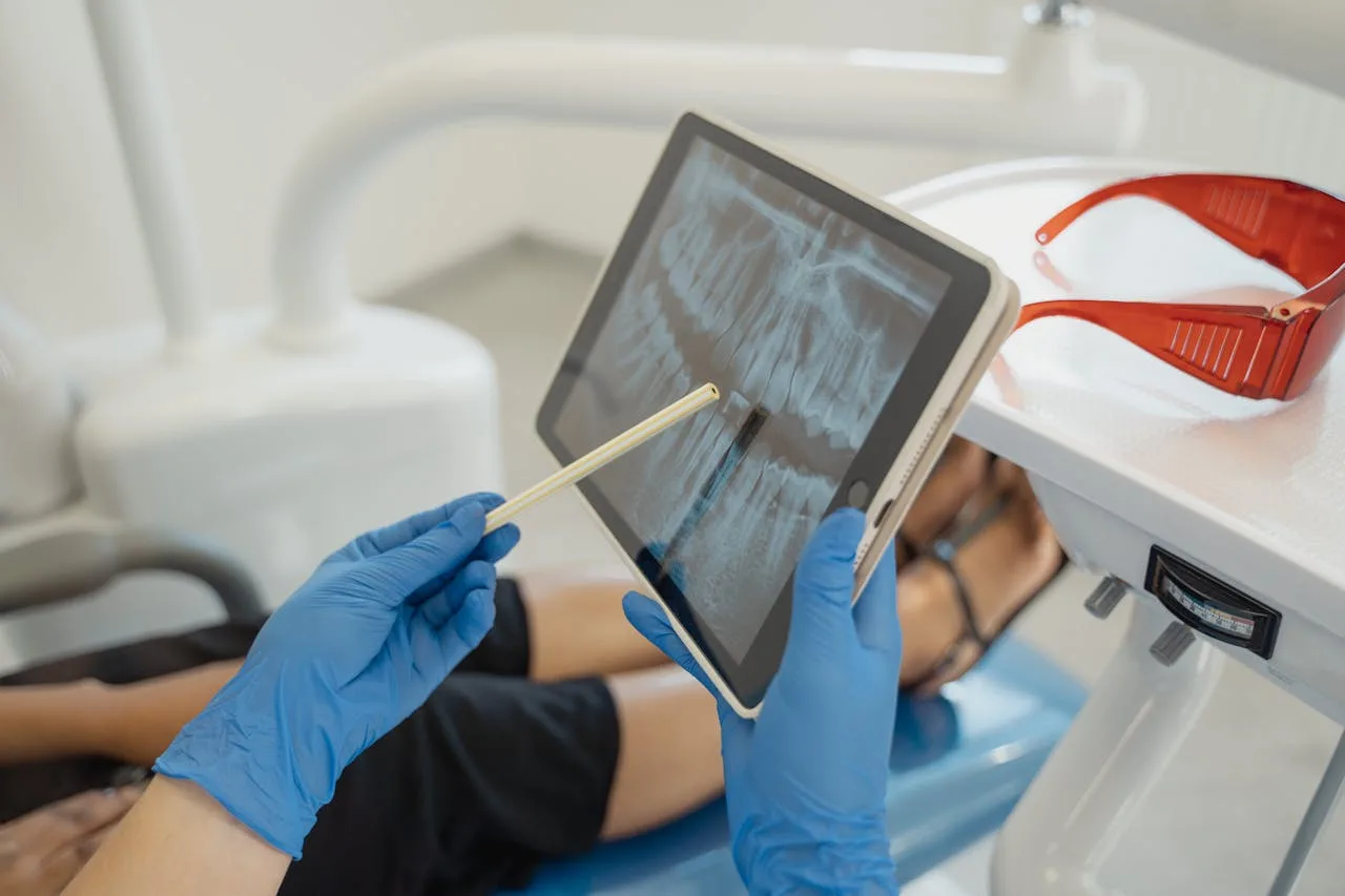 radiografie dentară boala parodontala
