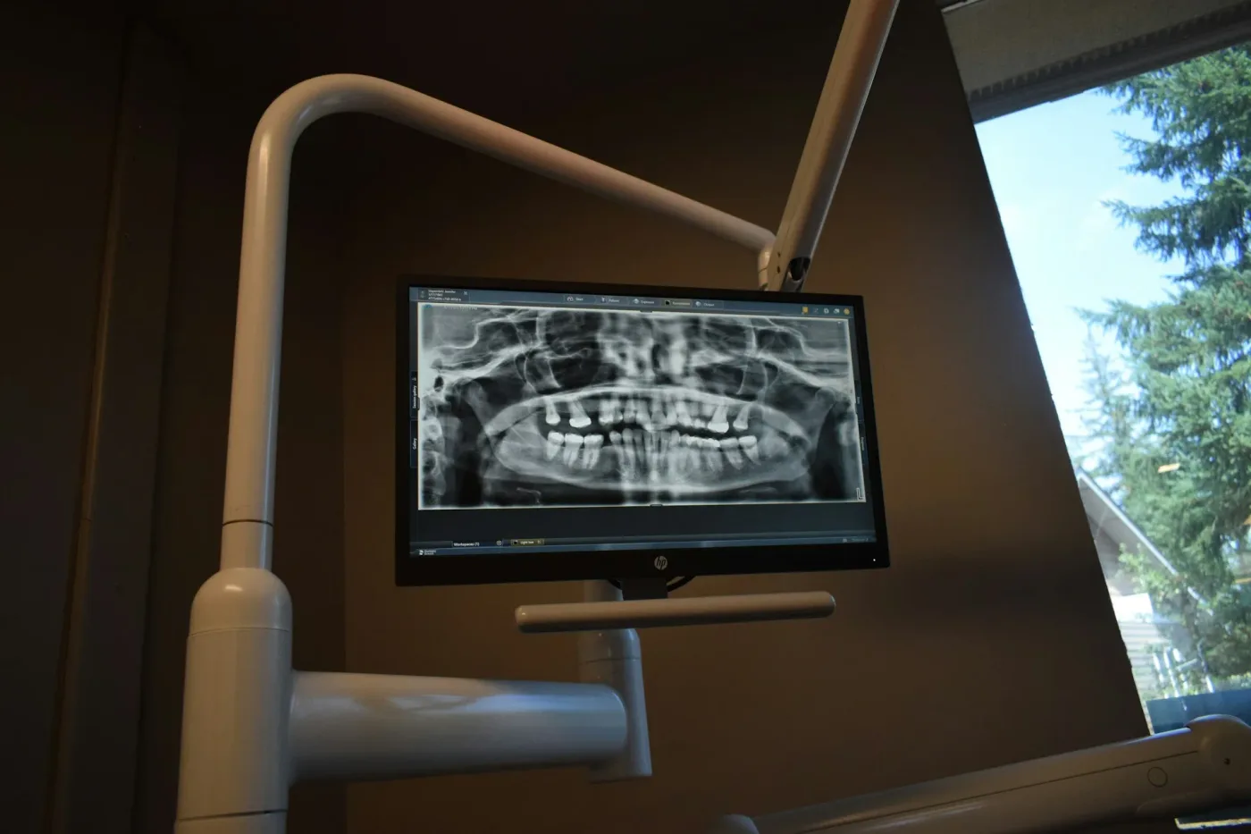 radiografie dentara dentetico brașov