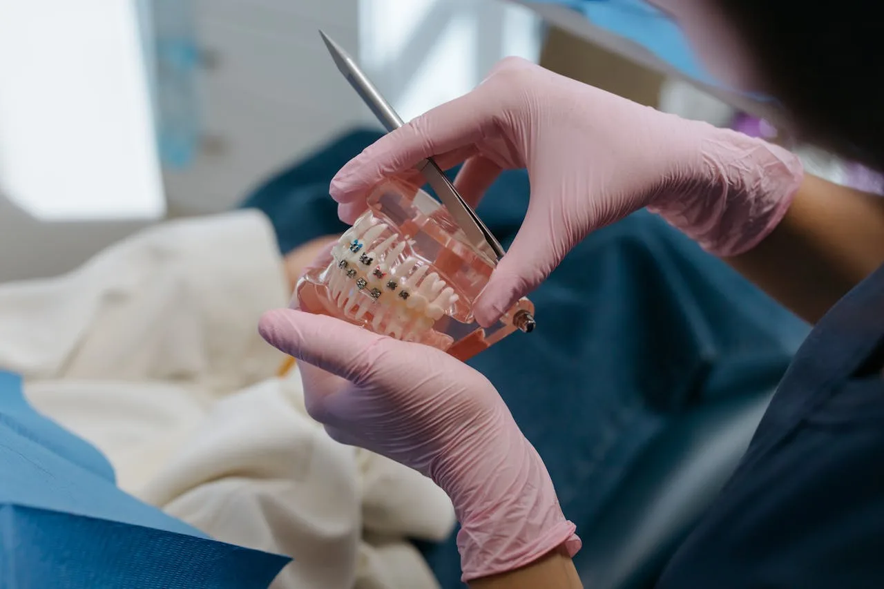 aparat dentar în funcție de vârstă